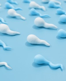 Что значит агрегация сперматозоидов в спермограмме