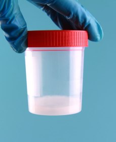 Что делать, если уменьшилось количество сперматозоидов в семенной жидкости