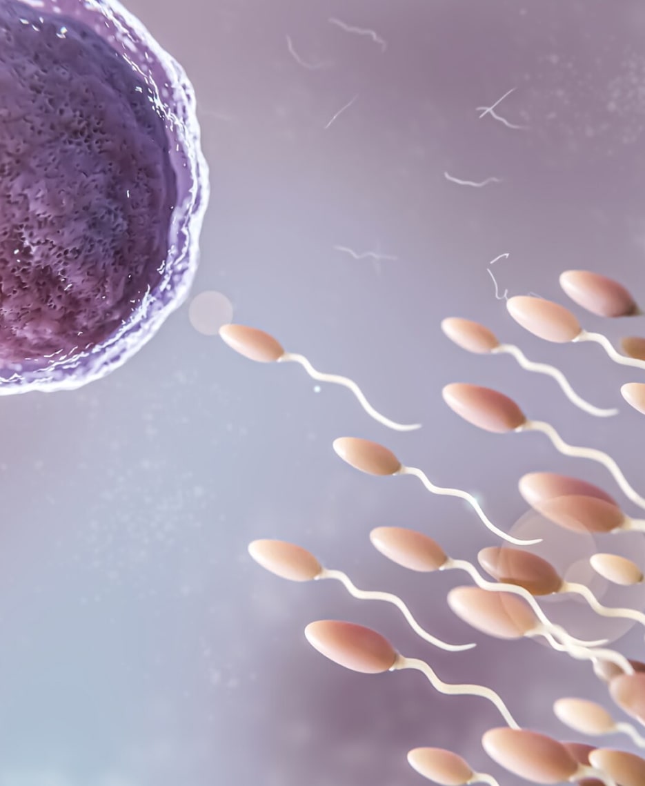Тератозооспермия: причины и лечение. Сперматозоиды патологических форм.