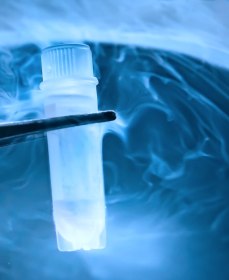 За какое время восстанавливается семенная жидкость для зачатия